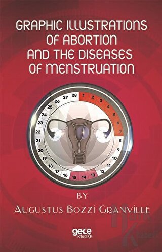 Graphic Illustrations Of Abortion And The Diseases Of Menstruation - H