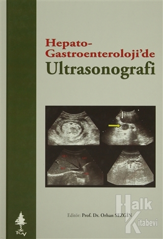Hepato Gastroenteroloji'de Ultrasonografi (Ciltli) - Halkkitabevi