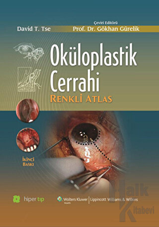 Oküloplastik Cerrahi (Ciltli)
