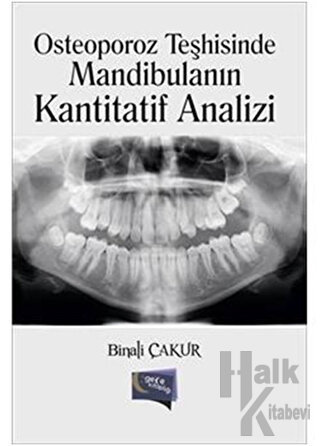 Osteoporoz Teşhisinde Mandibulanın Kantitatif Analizi - Halkkitabevi