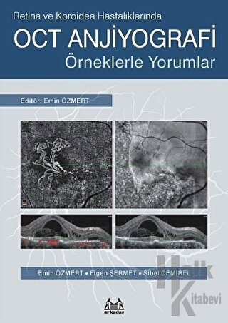 Retina ve Koroidea Hastalıklarında OCT Anjiyografi - Halkkitabevi